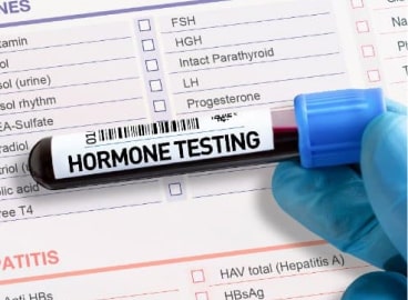A gloved hand holding a vial labeled "hormone testing" over a medical test form listing various hormones and other tests.