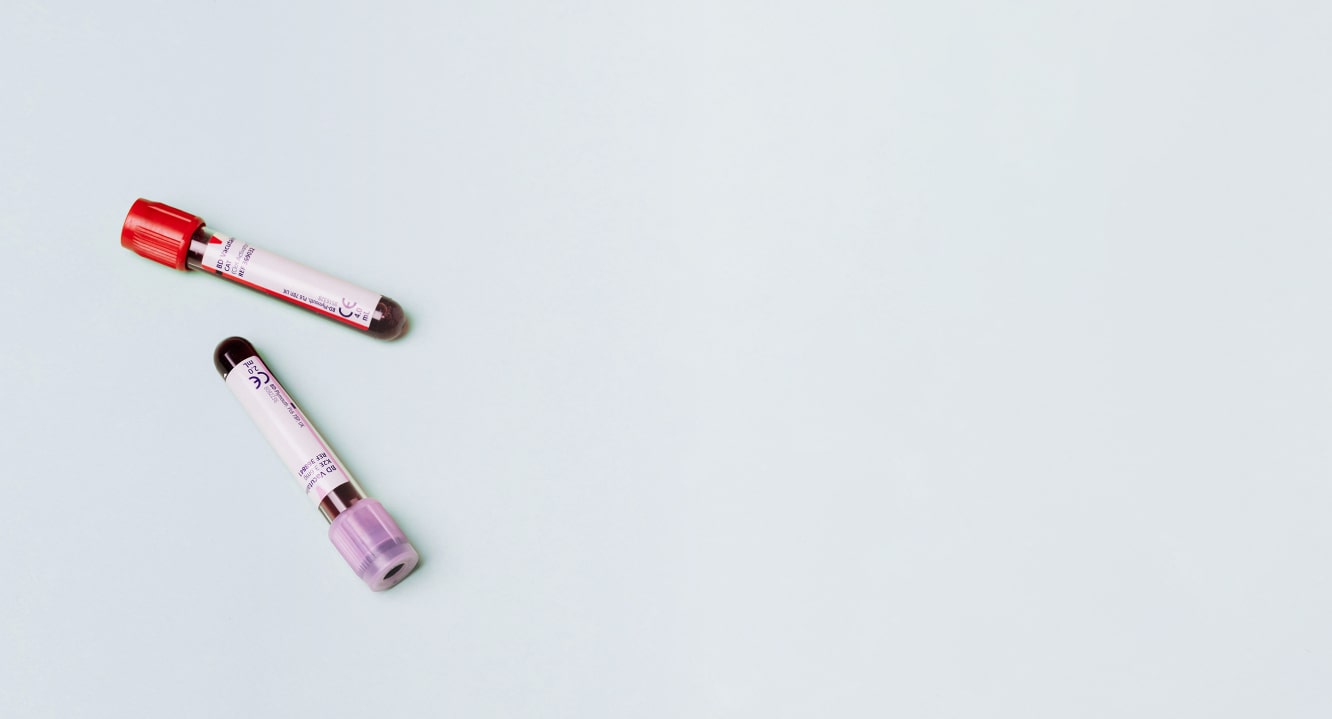 Two lip gloss tubes with red and purple caps lie on a light blue background, positioned towards the left with ample empty space on the right.